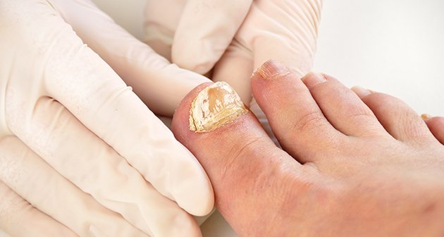 Centro de Regeneración Estética Renew Fitness y Spa - San Juan