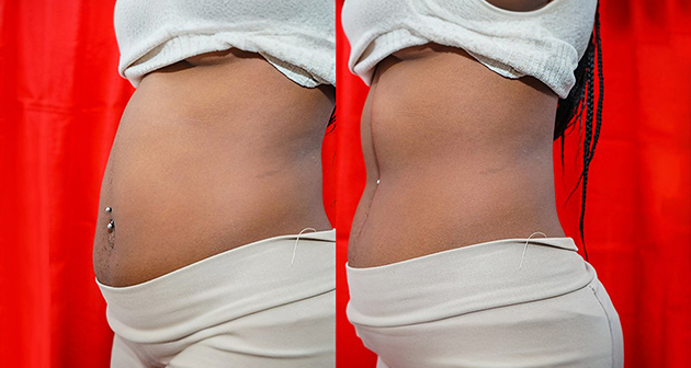 Cattleya Perfect 10 Med Spa - Southdale Plaza, Kingston